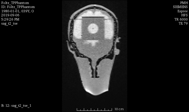 MRI Scans
