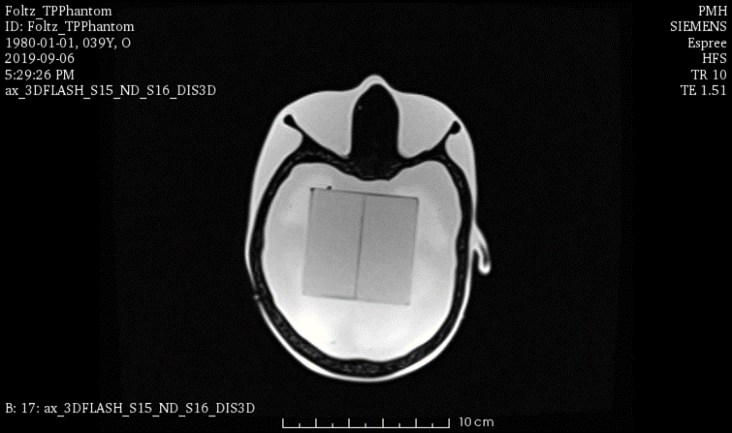 MRI Scans