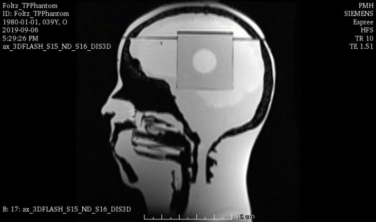 MRI Scans