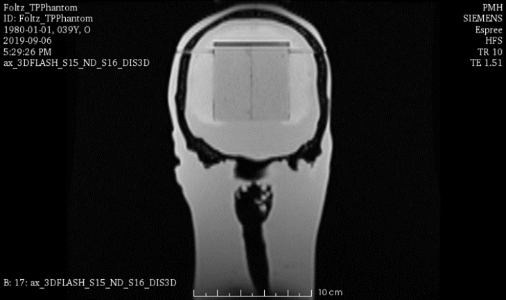 MRI Scans