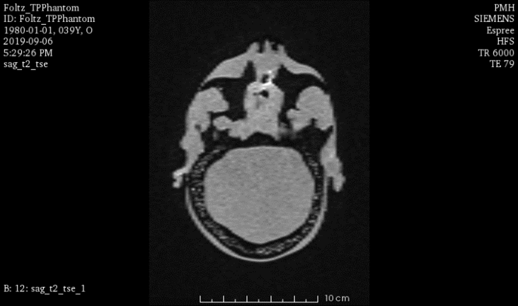 MRI Scans