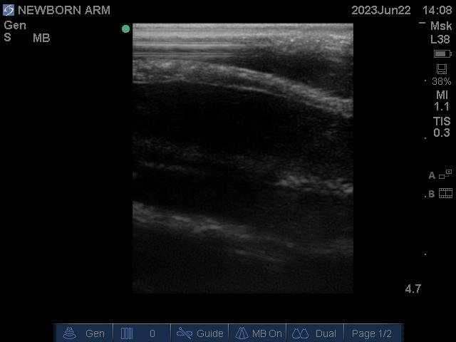 Ultrasound Scans