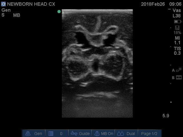 Ultrasound Scans