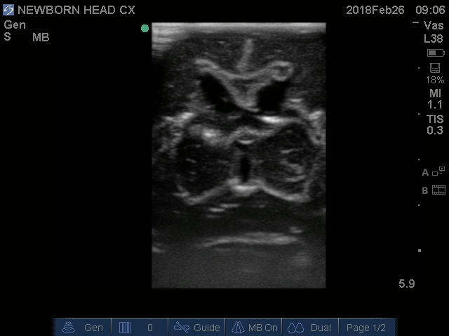 Ultrasound Scans