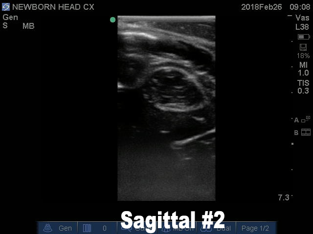 Ultrasound Scans