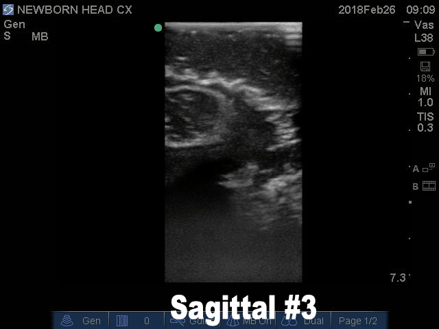 Ultrasound Scans