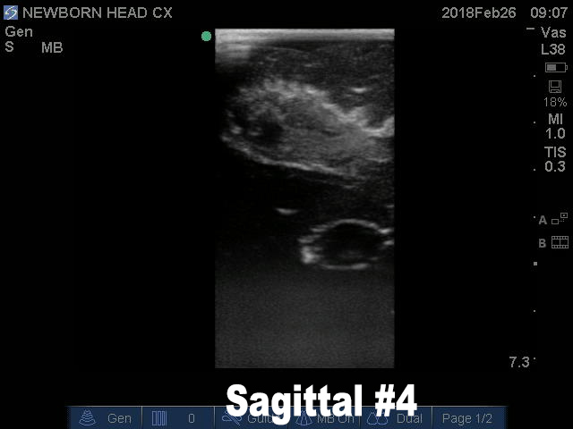 Ultrasound Scans