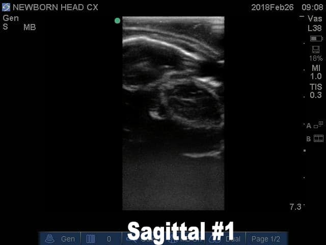 Ultrasound Scans