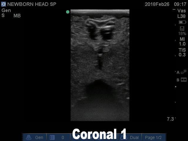 Ultrasound Scans