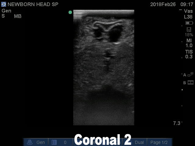 Ultrasound Scans
