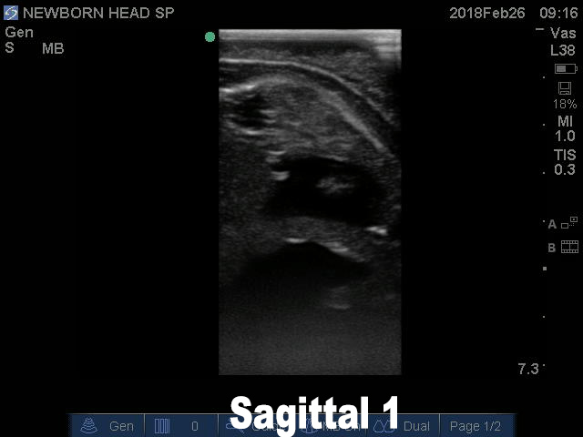 Ultrasound Scans