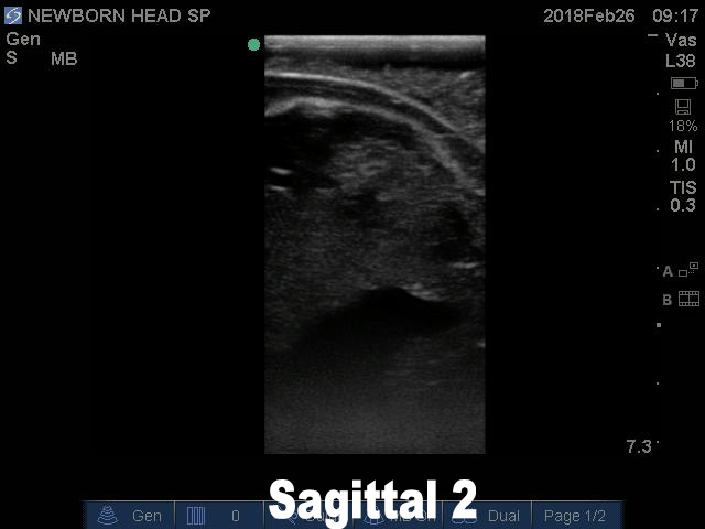 Ultrasound Scans