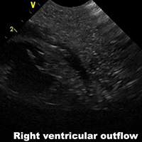 Ultrasound Scans