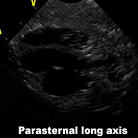 Ultrasound Scans
