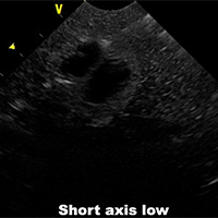 Ultrasound Scans