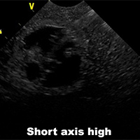 Ultrasound Scans