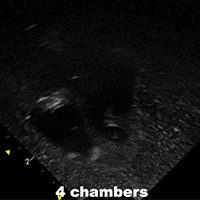 Ultrasound Scans