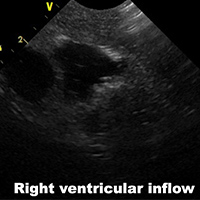 Ultrasound Scans