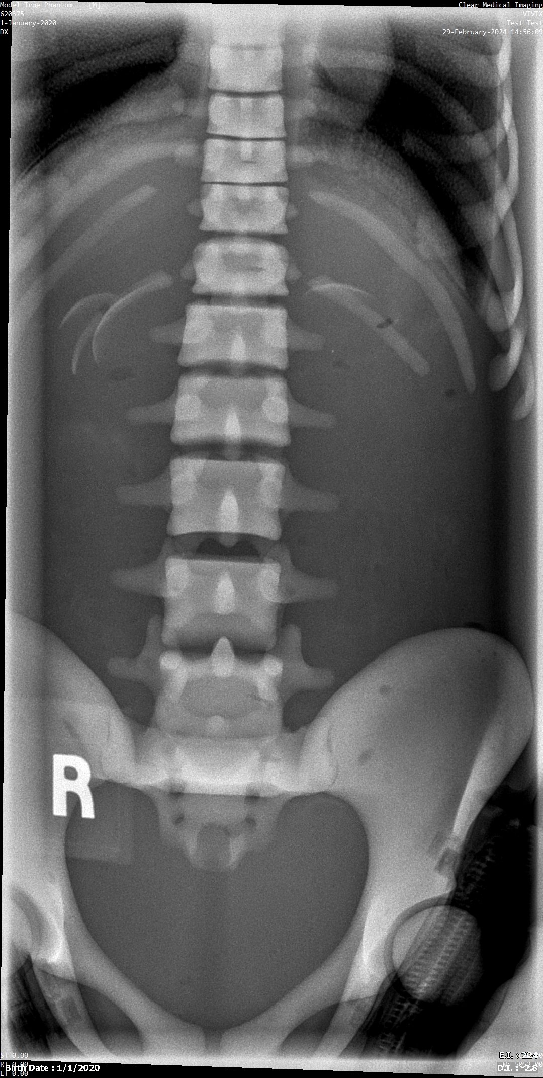 X-Ray Scans