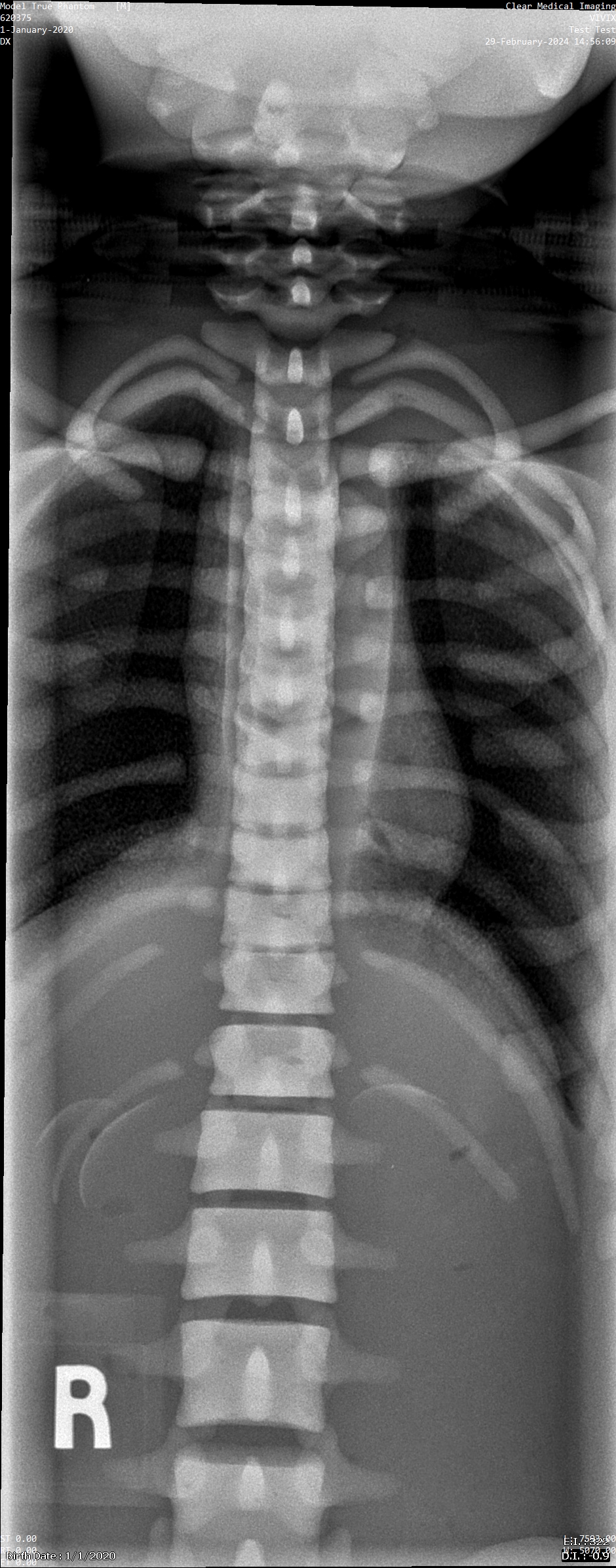 X-Ray Scans