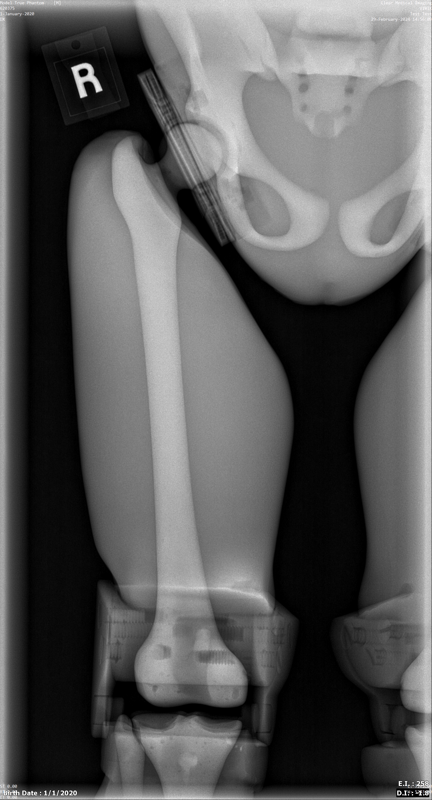 X-Ray Scans