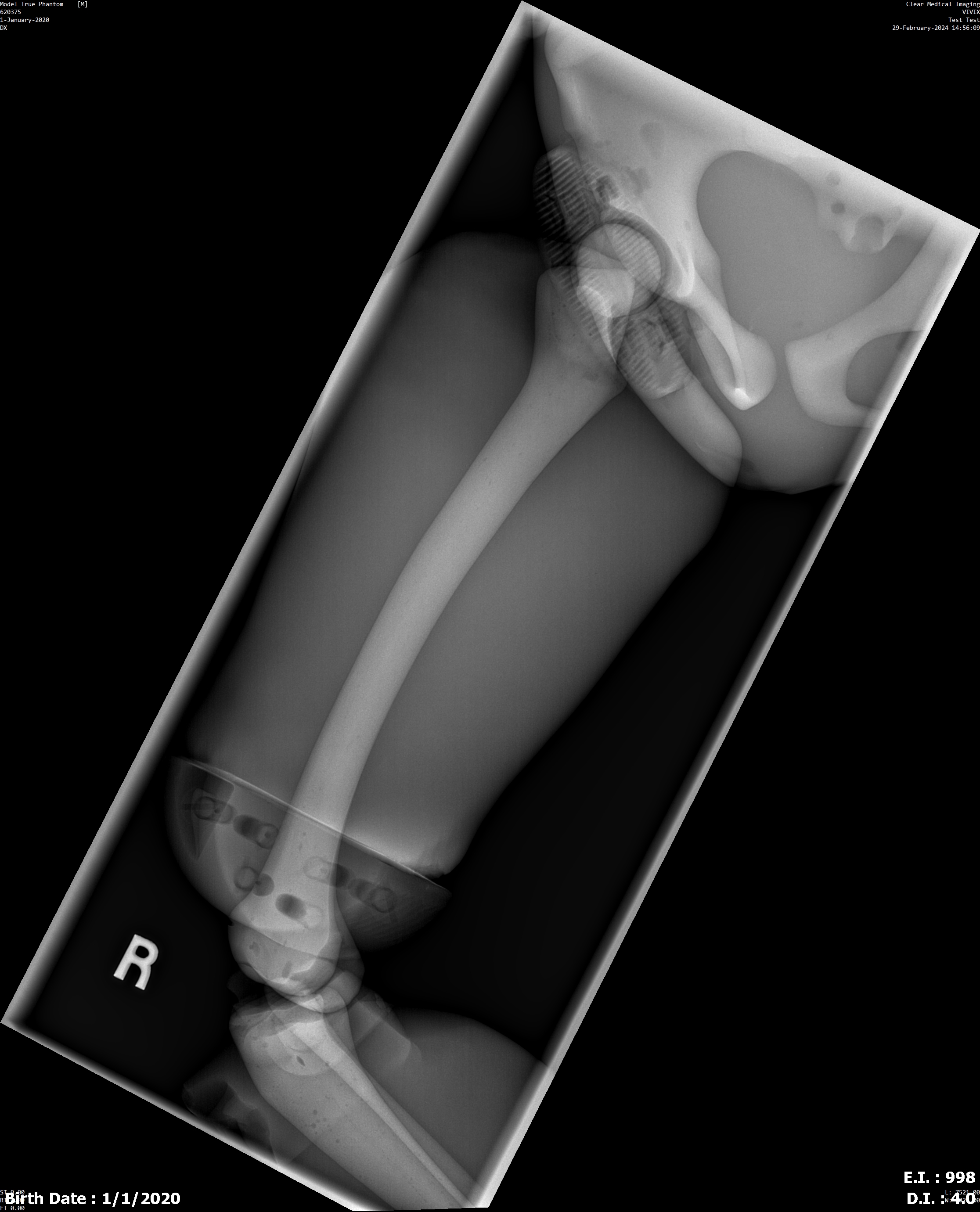X-Ray Scans