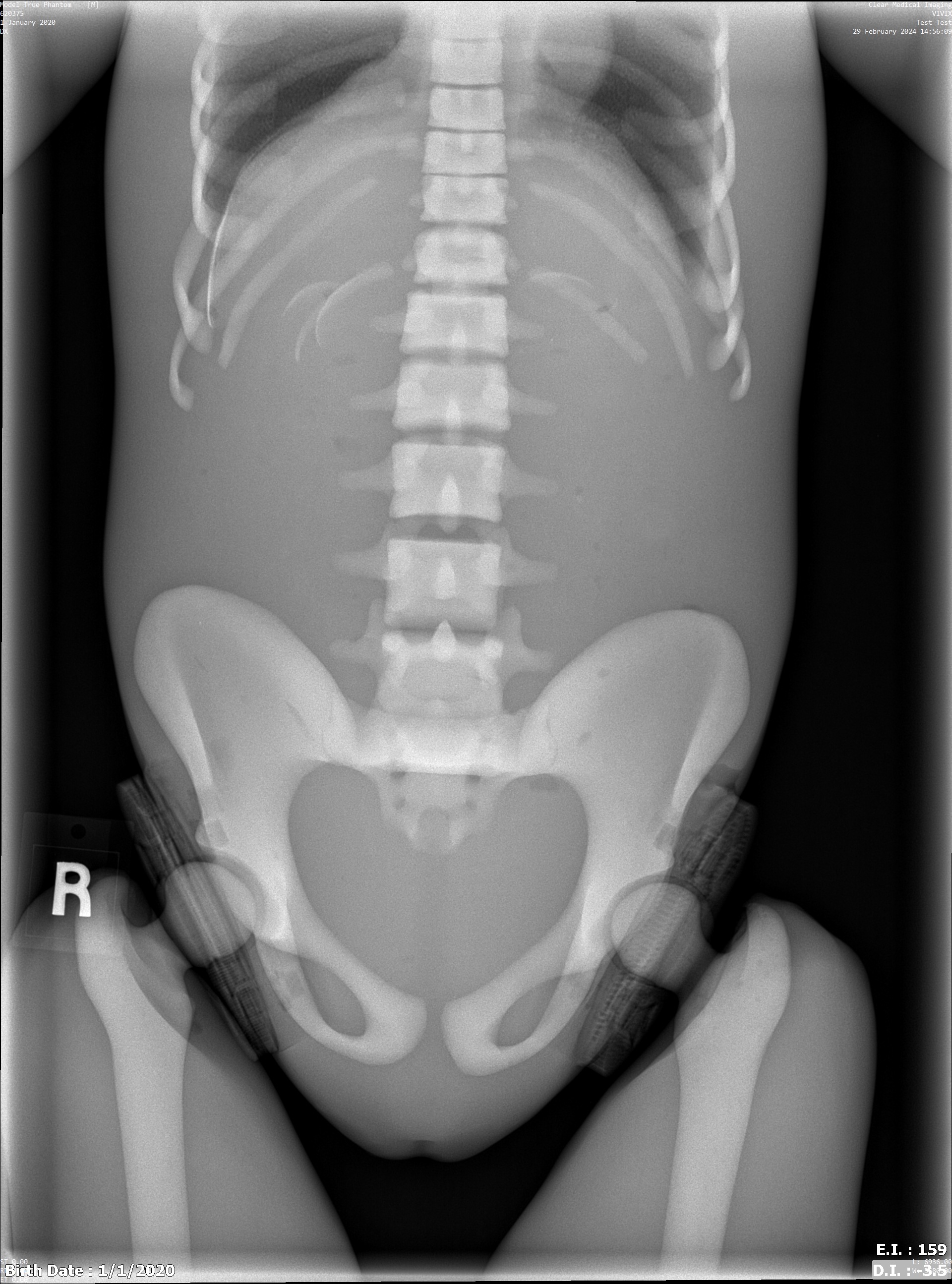 X-Ray Scans