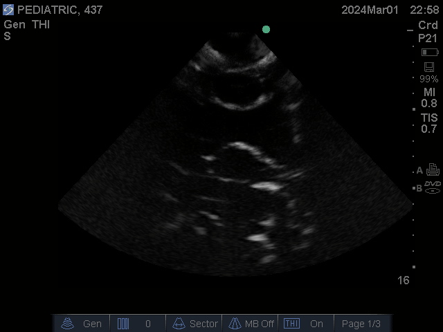 Ultrasound Scans