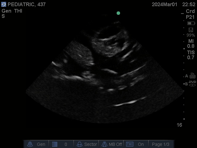 Ultrasound Scans