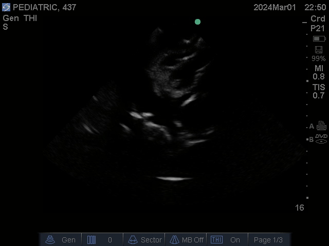 Ultrasound Scans