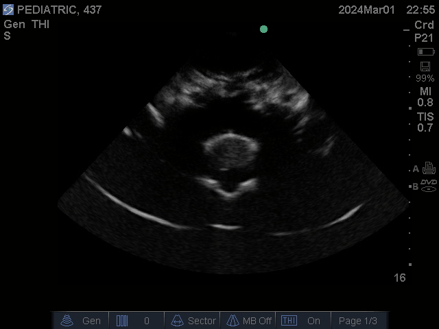 Ultrasound Scans