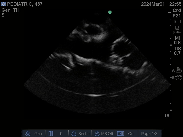 Ultrasound Scans