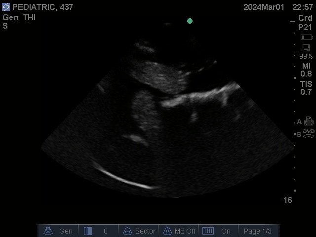 Ultrasound Scans