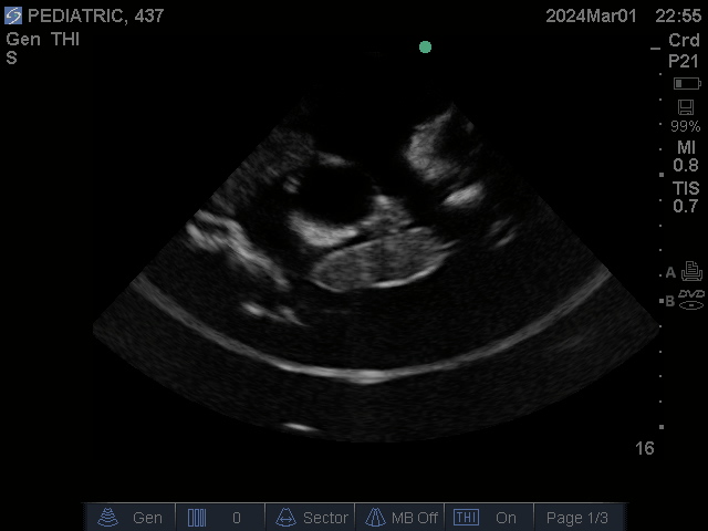 Ultrasound Scans
