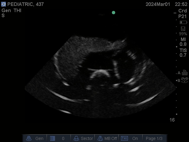 Ultrasound Scans