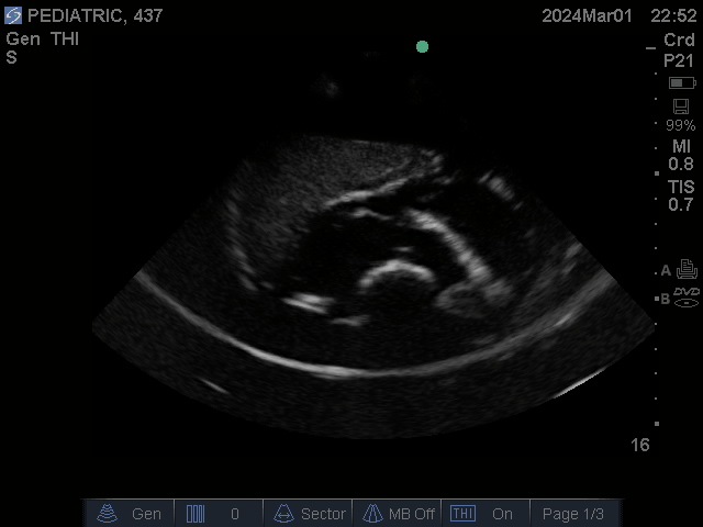Ultrasound Scans
