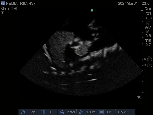 Ultrasound Scans