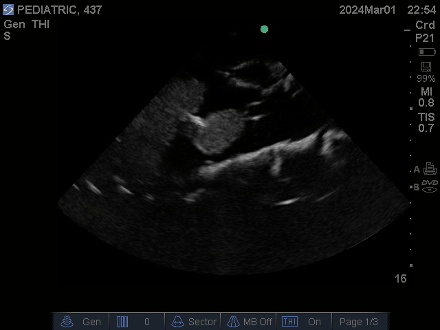 Ultrasound Scans