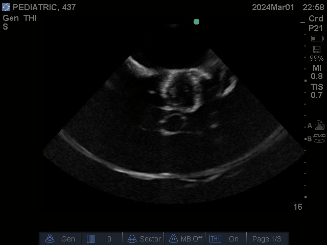 Ultrasound Scans