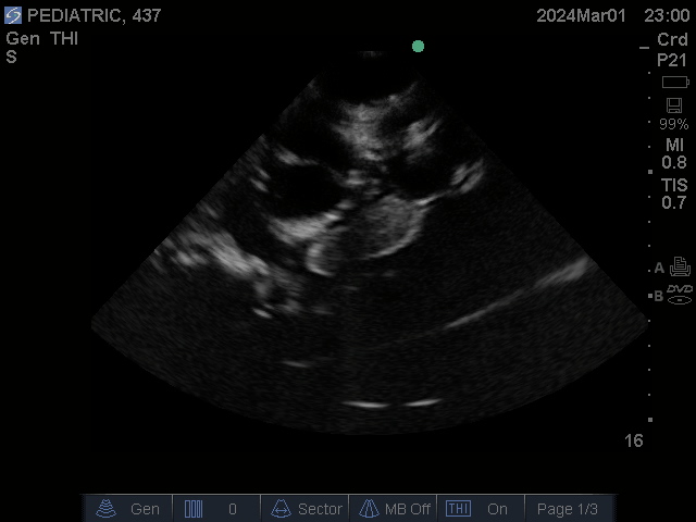 Ultrasound Scans