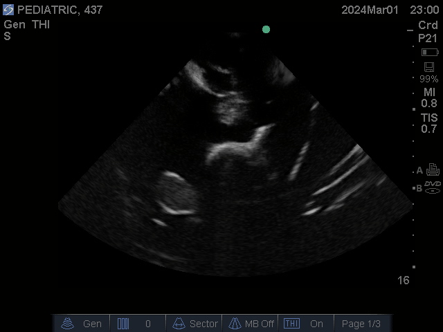 Ultrasound Scans
