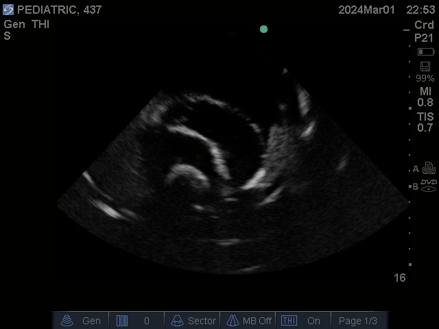 Ultrasound Scans