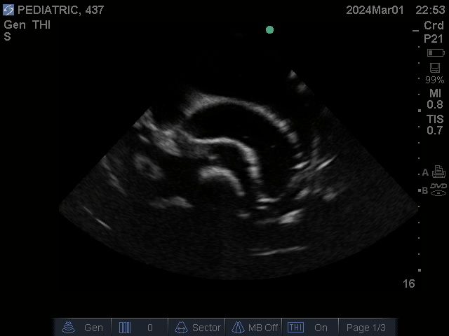 Ultrasound Scans