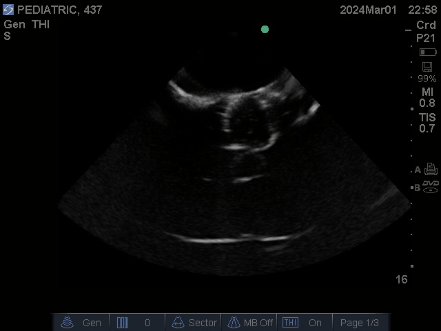 Ultrasound Scans