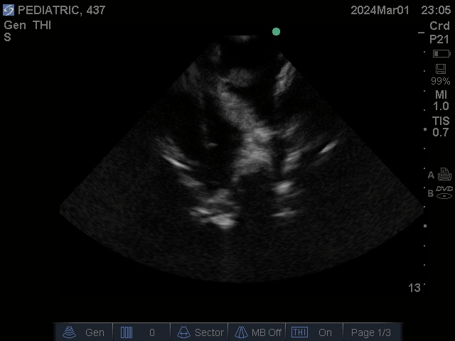 Ultrasound Scans