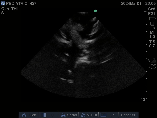 Ultrasound Scans