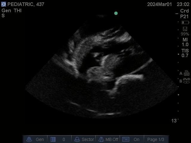 Ultrasound Scans