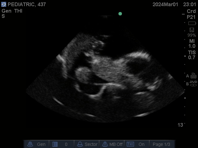 Ultrasound Scans