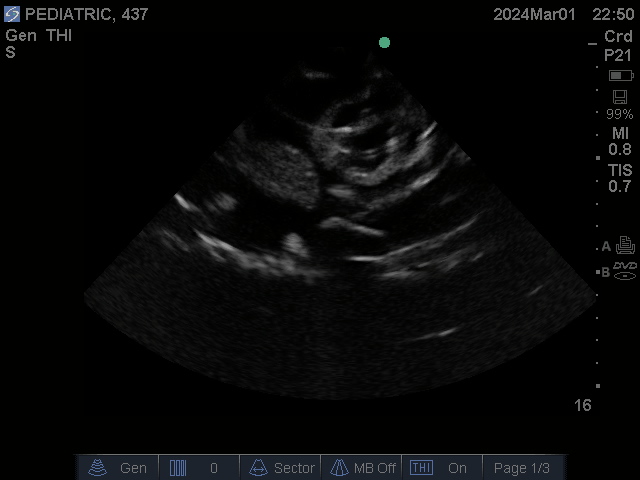 Ultrasound Scans