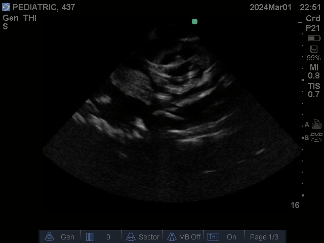 Ultrasound Scans